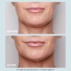 Cryo-Flash-Maske – porenverfeinernde + straffende Gel-Creme-Gesichtsmaske