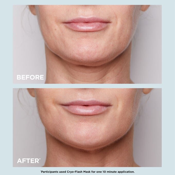 Cryo-Flash-Maske – porenverfeinernde + straffende Gel-Creme-Gesichtsmaske