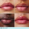 Cryo-Plumping-Lippen-Set