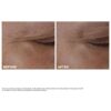 Double Serum Eye + Total Eye Lift Duo | Die meistverkaufte Anti-Aging-Augenpflege | Total Eye Lift – für einen sichtbaren Augenlifting-Effekt in 30 Sekunden