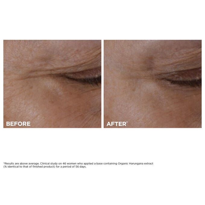 Double Serum Eye + Total Eye Lift Duo | Die meistverkaufte Anti-Aging-Augenpflege | Total Eye Lift – für einen sichtbaren Augenlifting-Effekt in 30 Sekunden