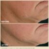 Extra-Firming, nachfüllbare Tagesfeuchtigkeitscreme mit Kollagen-Polypeptid + Niacinamid