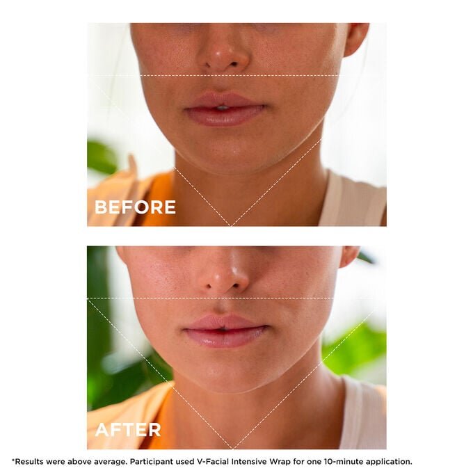 V-Facial Intensive Wrap – entschwellende Gesichtsmaske